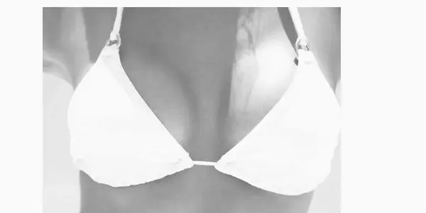 Woman representing breast rejuvenation and natural breast enhancement in Tampa Bay