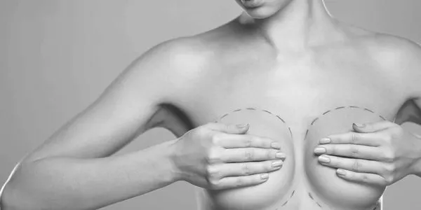 Breast revision surgery